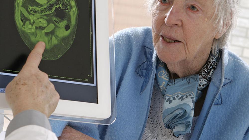 Стадии болезни Альцгеймера: от первых симптомов до поздних стадий - как обеспечить качественный уход и когда стоит рассмотреть пансионат Стадии болезни Альцгеймера: от первых симптомов до поздних стадий - как обеспечить качественный уход и когда стоит рассмотреть пансионат